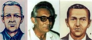 Composite, aged regressed, w B and Duane