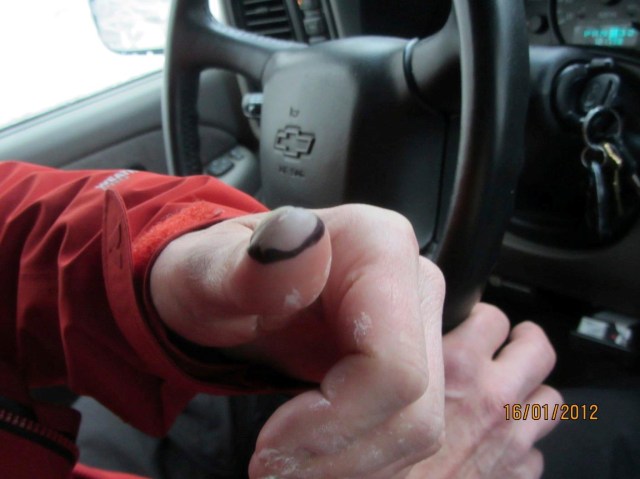 Mt. Rainier, Jo and Jim, frostbite, Jim, left hand